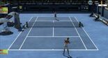Test Tennis Elbow 4